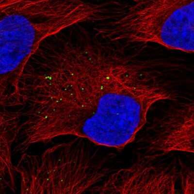 Immunocytochemistry/ Immunofluorescence: KISS1 Antibody [NBP2-34010]