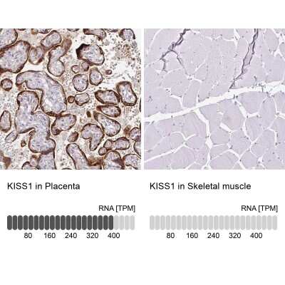 Immunohistochemistry-Paraffin: KISS1 Antibody [NBP2-34010]