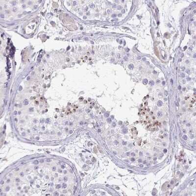 Immunohistochemistry-Paraffin: KISS1 Antibody [NBP2-34010]