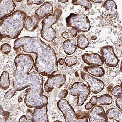 Immunohistochemistry-Paraffin: KISS1 Antibody [NBP2-34010]