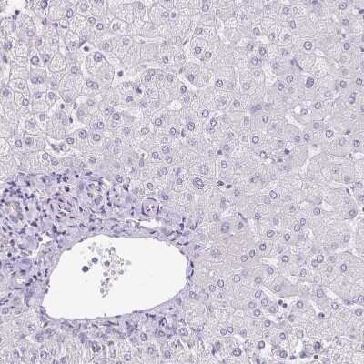 Immunohistochemistry-Paraffin: KISS1 Antibody [NBP2-34010]