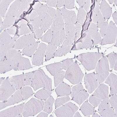 Immunohistochemistry-Paraffin: KISS1 Antibody [NBP2-34010]