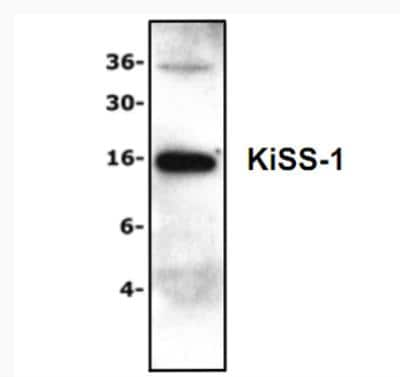 Western Blot: KISS1 Antibody [NBP1-45672]