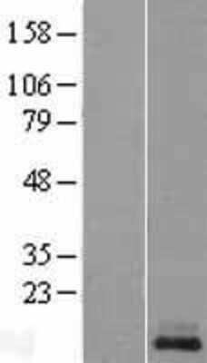 Western Blot: KISS1 Overexpression Lysate [NBL1-12305]