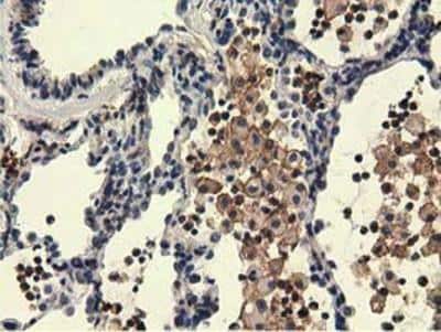 Immunohistochemistry-Paraffin: KIST Antibody (OTI2H4) [NBP2-03027]
