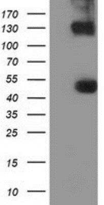 Western Blot: KIST Antibody (OTI2H4) [NBP2-03027]