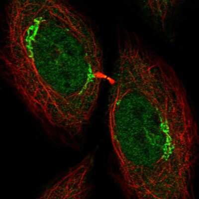 Immunocytochemistry/ Immunofluorescence: KIST Antibody [NBP2-56531]