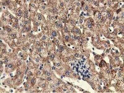 Immunohistochemistry: KIST Antibody (OTI2H4) - Azide and BSA Free [NBP2-72383]