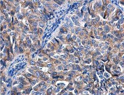 Immunohistochemistry-Paraffin: KIZUNA Antibody [NBP2-17065]