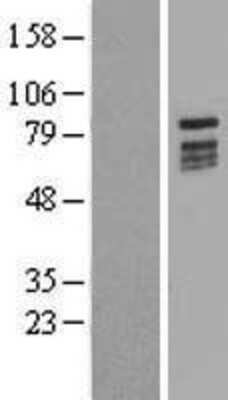 Western Blot: KIZUNA Overexpression Lysate [NBL1-08365]