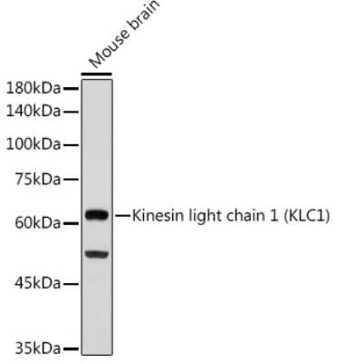 Western Blot: KLC1 Antibody (5C3P5) [NBP3-15712]