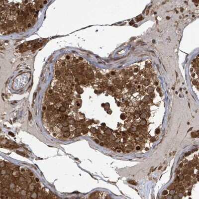 Immunohistochemistry-Paraffin: KLC1 Antibody [NBP2-33425]