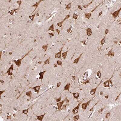 Immunohistochemistry-Paraffin: KLC1 Antibody [NBP2-33649]