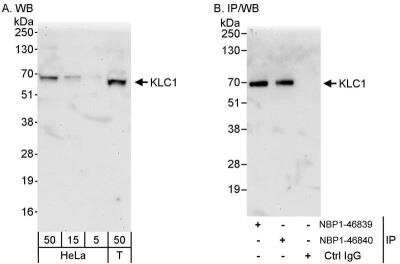 Western Blot: KLC1 Antibody [NBP1-46840]