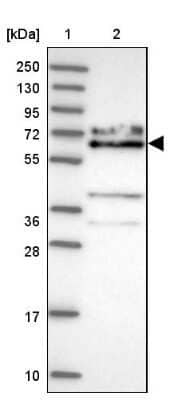 Western Blot: KLC1 Antibody [NBP2-33425]