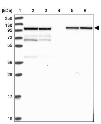 Western Blot: KLC1 Antibody [NBP2-33649]