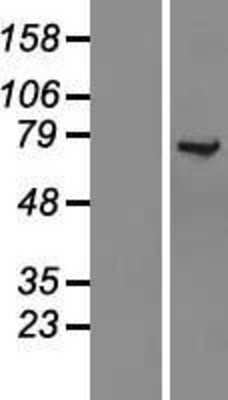 Western Blot: KLC1 Overexpression Lysate [NBL1-12308]