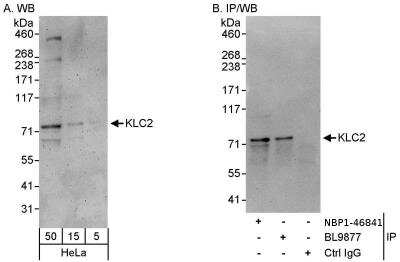 Immunoprecipitation: KLC2 Antibody [NBP1-46841]