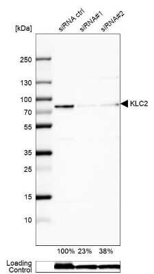 Western Blot: KLC2 Antibody [NBP1-83722]