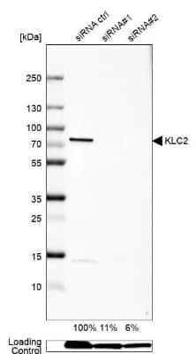 Western Blot: KLC2 Antibody [NBP1-83723]