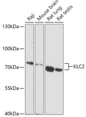 Western Blot: KLC2 AntibodyAzide and BSA Free [NBP3-04812]