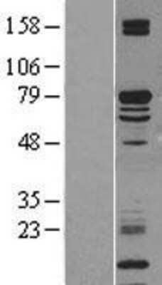 Western Blot: KLC2 Overexpression Lysate [NBL1-12309]