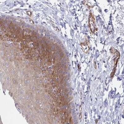 Immunohistochemistry-Paraffin: KLC3 Antibody [NBP2-38794]