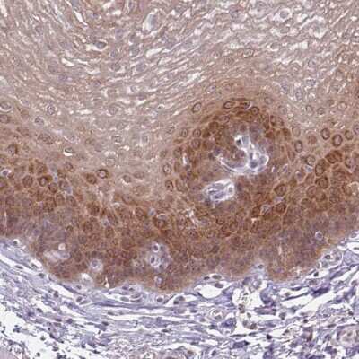 Immunohistochemistry-Paraffin: KLC3 Antibody [NBP2-14162]