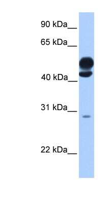 Western Blot: KLC3 Antibody [NBP1-54771]