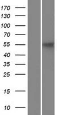 Western Blot: KLC3 Overexpression Lysate [NBP2-05035]