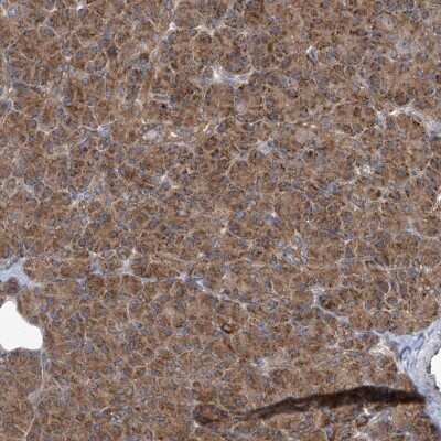 Immunohistochemistry-Paraffin: KLC4 Antibody [NBP1-88772]