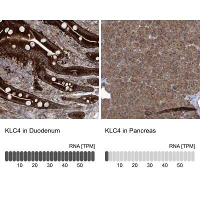 Immunohistochemistry-Paraffin: KLC4 Antibody [NBP1-88772]