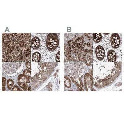 Immunohistochemistry-Paraffin: KLC4 Antibody [NBP1-88772]