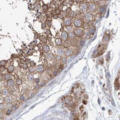 Immunohistochemistry-Paraffin: KLC4 Antibody [NBP1-88772]