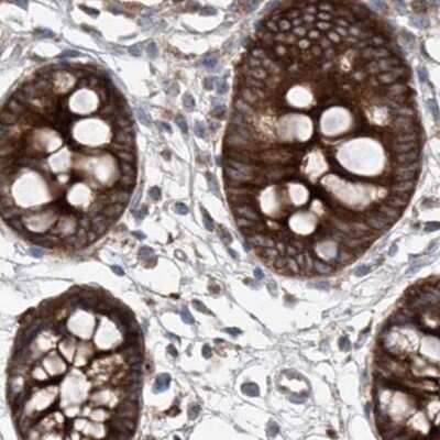 Immunohistochemistry-Paraffin: KLC4 Antibody [NBP1-88772]