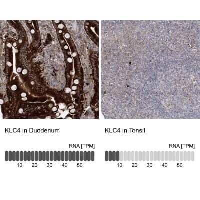 Immunohistochemistry-Paraffin: KLC4 Antibody [NBP1-88772]