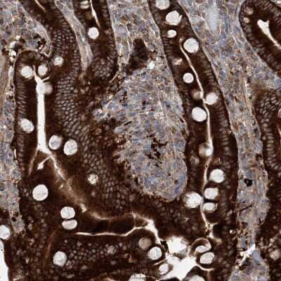 Immunohistochemistry-Paraffin: KLC4 Antibody [NBP1-88772]