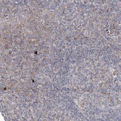Immunohistochemistry-Paraffin: KLC4 Antibody [NBP1-88772]