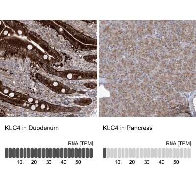 Immunohistochemistry-Paraffin: KLC4 Antibody [NBP1-88773]