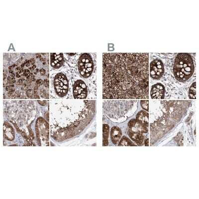 Immunohistochemistry-Paraffin: KLC4 Antibody [NBP1-88773]