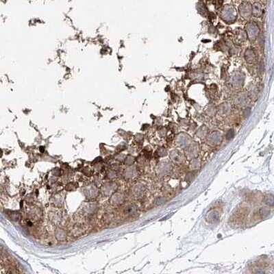 Immunohistochemistry-Paraffin: KLC4 Antibody [NBP1-88773]