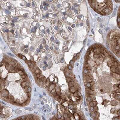 Immunohistochemistry-Paraffin: KLC4 Antibody [NBP1-88773]