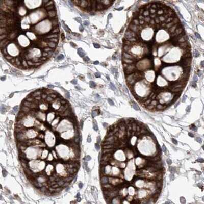Immunohistochemistry-Paraffin: KLC4 Antibody [NBP1-88773]