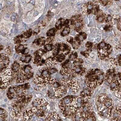 Immunohistochemistry-Paraffin: KLC4 Antibody [NBP1-88773]