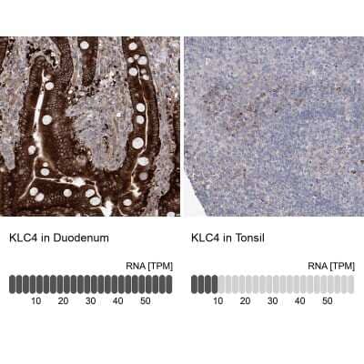 Immunohistochemistry-Paraffin: KLC4 Antibody [NBP1-88773]