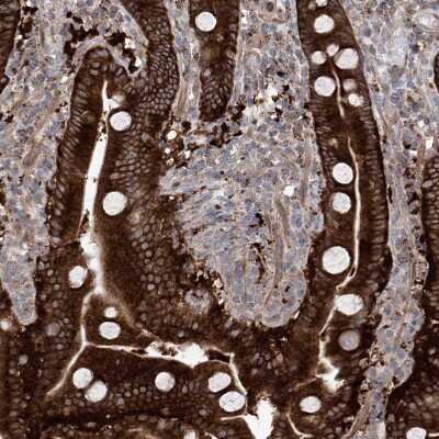 Immunohistochemistry-Paraffin: KLC4 Antibody [NBP1-88773]