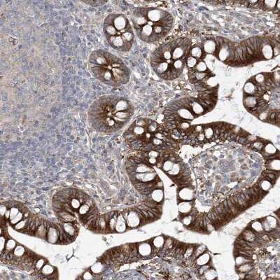 Immunohistochemistry-Paraffin: KLC4 Antibody [NBP1-88773]