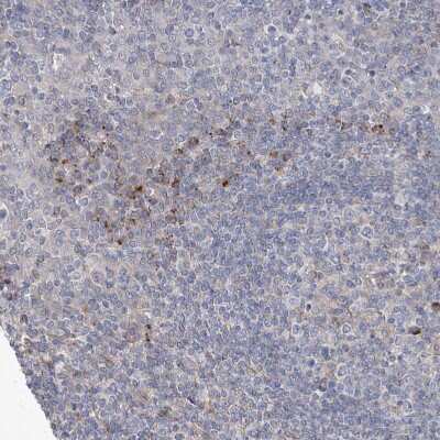 Immunohistochemistry-Paraffin: KLC4 Antibody [NBP1-88773]