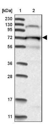 Western Blot: KLC4 Antibody [NBP1-88772]