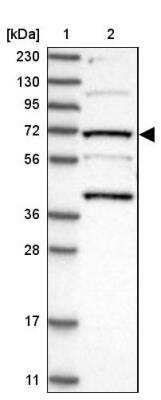 Western Blot: KLC4 Antibody [NBP1-88773]